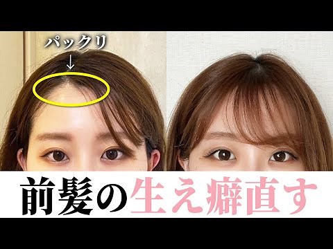 【前髪つむじ】簡単にパックリ割れる前髪を直す方法♡もう生えぐせに悩まない！