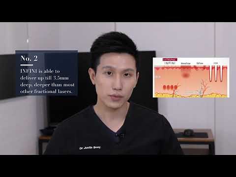 INFINI Laser - 3 Things You Need to Know