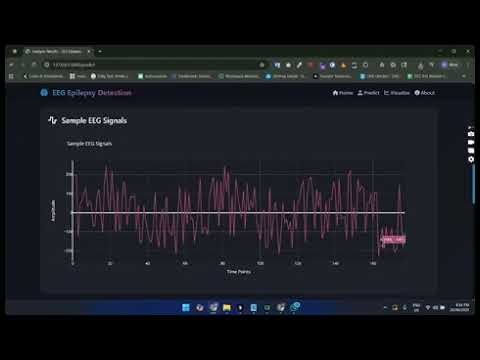 Advanced EEG Epilepsy Detection System - Hybrid Quantum-Classical AI