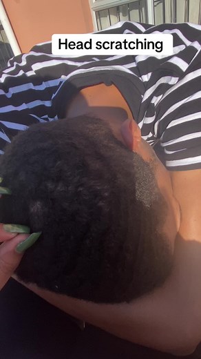 #headscratching #scratching #asmr #scratchingasmr