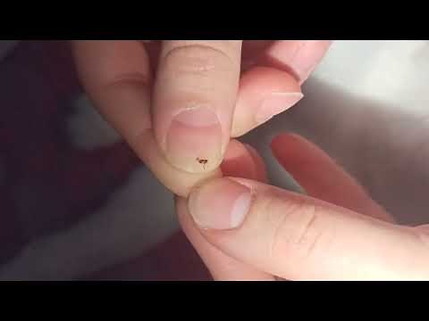 Cat Flea Removal ASMR 🪳