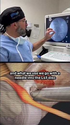 Why Your Leg Is Tingling: Dr. Ibrahim Explains Disc Herniations