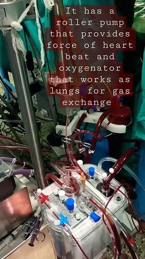 Heart Lung Machine / Open Heart Surgery / Perfusionists