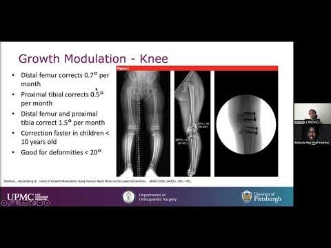 Lower Extremity Deformity