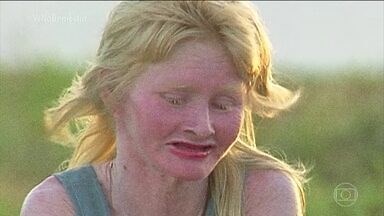 Maior comunidade de albinos do Brasil vive em uma ilha do Maranhão