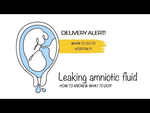 Did My Water Break?How to Know & What to Do!