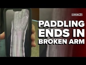 Student's arm broke during school paddling after mother gave permission