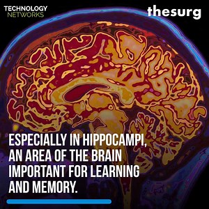 25K views · 370 reactions | Researchers have shown that healthy older men and women can generate just as many new brain cells as younger people. Reference: https://bit.ly/2RT4S9e Video by The Surg | Neuroscience News and Research | Facebook