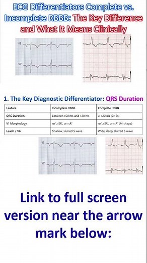 ECG Differentiators: Complete vs Incomplete RBBB—The Key Difference and What It Means Clinically