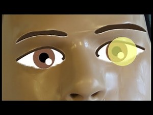 Disability / Bewustzijn + Neurologisch uitval