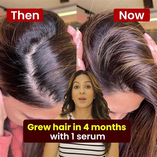 5.2K views · 15 reactions | OZiva's newest launch: Ultimate hairfall solution with Scientist Formulated.Pure Plant Actives ✅23,800 new hair in 4 months ✅Clinically Proven to deliver real results ✅Goodness of Redensyl, Lindera Root and Basil Root extracts | OZiva | Facebook