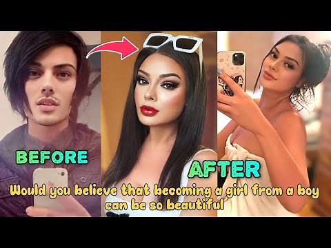 This Boy is Living His Dream Life after Becoming a Girl | Male to Female Transition | MTF Transition