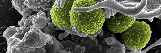 The “Asgard archaea” are our own cells’ closest relatives