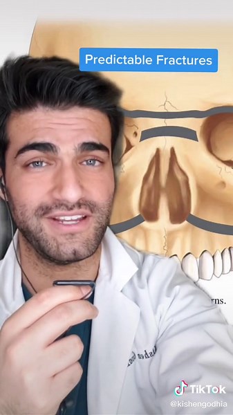 Understanding Common Skull Fractures: Exploring René Le Fort's Impact