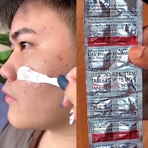 213K views · 1.7K reactions | SKIN WHITENING MAGICAL MASK - GET FAIR SKIN IN 15 MINUTES #glowingskin #skinwhitening #antiaging #pigmentation #beauty #diy #SkinCare #homemade | Anmol Hindi | Facebook