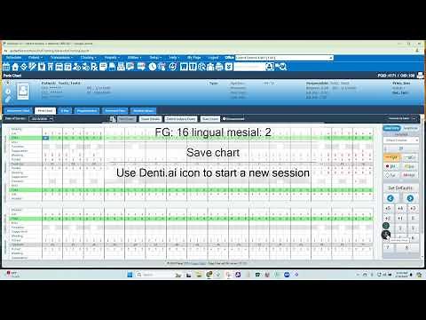 Voice Enabled Perio Charting & PHI Reporting for Denticon with Denti AI Voice