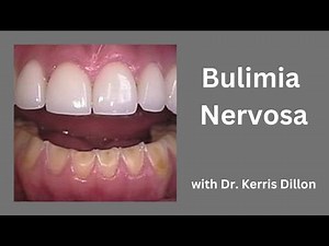 Bulimia Nervosa