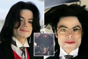Michael Jackson was actually BALD with just a tiny amount of ‘peach fuzz’ on his scalp