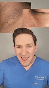 42K views · 673 reactions | What are those skin colored bumps in your armpits, neck and eyes? They're skin tags! But do they need to be removed? #whatsonmyface #whatsonmyskin #skintags #fibroepithelialpolyp #acrochordon #whatareskintags #todayilearned #dermatologist | Scott Walter MD, FAAD | Facebook