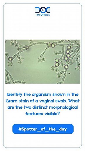 What are the two distinct morphological features visible?