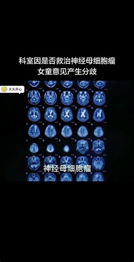 #追剧 #电视剧推荐 #医疗剧推荐 #仁心俱乐部 科室因是否救治神经母细胞瘤女童意见产生分歧