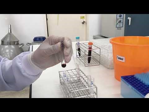 Preparation of RBC suspension