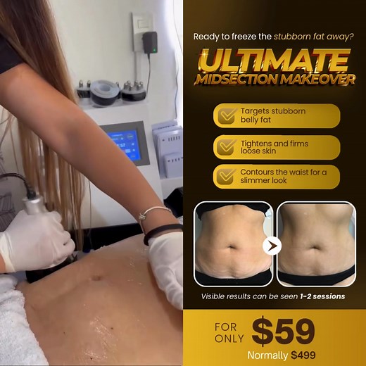  Walnut Creek Ladies! Ready to Slim, Sculpt & Glow for the Holidays?...