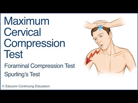 Maximum Cervical Compression Test (Spurling’s Test) - A Chiropractic Online CE™ Production