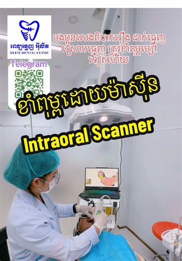 ខាំពុម្ពដោយប្រើ Intraoral Scanner បច្ចេកវិជ្ជាថ្មី