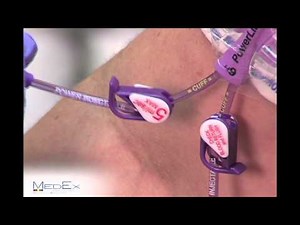 Step 8- Clamp Release