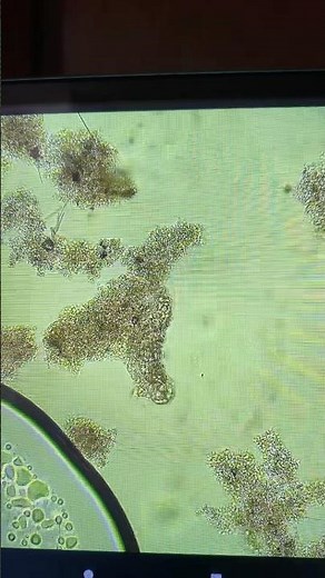 So many Microorganisms in 1 Drop of Wastewater. #wastewatertreatment #wastewater #turdnerd