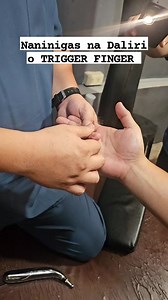 Ang trigger finger ay nangyayari kapag ang litid (tendon) ng daliri ay namamaga o naiipit sa makitid na lagusan (sheath) na dinadaanan nito. Dahil dito, nahihirapan ang litid na gumalaw nang maayos, kaya parang may "kumakapit" o "tumatalon" na pakiramdam kapag binabaluktot o iniunat ang daliri. Our Branches Locations: 🗺 Hilot Galing Bagong Silang North Caloocan ☎️ 0992 292 0308 Gmap https://maps.app.goo.gl/JBgoTGtw6YEDBcrJ6 🗺 Hilot Galing Gaya Gaya SJDM Bulacan ☎️ 0992 292 0292 Gmap https://ma