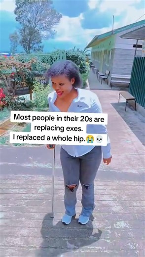 Hip replacement in my 20's #hipdysplasia #beautyindiversity #hipreplacementrecovery 