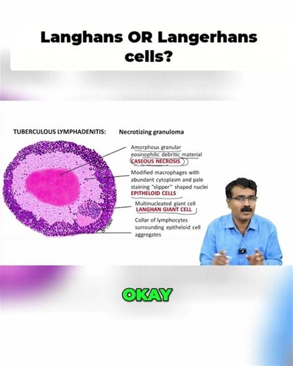 Langerhans vs Langhans Cells !