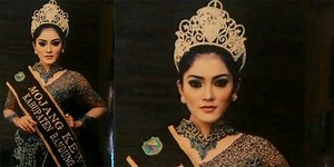 Model cantik Bandung ditusuk ogah difoto bugil | merdeka.com