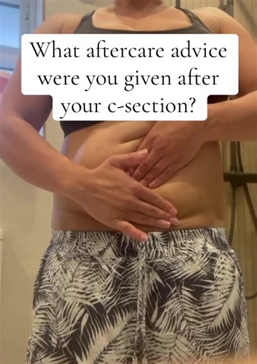 I often wish we were shown or given a simple leaflet explaining how C-section mamas can properly care for and massage our scars. Because scars don’t have to be: • Numb • Painful • Raised • Tight • Restrictive • Sore If we spent just five minutes each day, the difference it could make to our scars would be HUGE. #fyp #csectionrecovery #csection #postnatal #postpartumbody