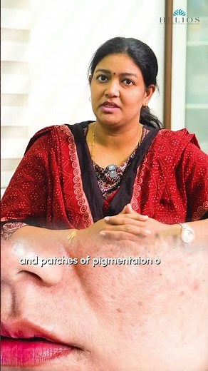 Pigmentation Explained: Why You Need to See a Dermatologist | Dr. Pallavi #heliosclinic