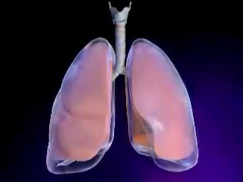 Pneumothorax What Is a Pneumothorax or Collapsed Lung