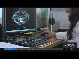 Doctors recommend fallopian tube removal to prevent ovarian cancer