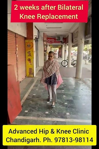 Patient walking strong 2 weeks after Bilateral Knee Replacement- Revolutionizing Patient Recovery