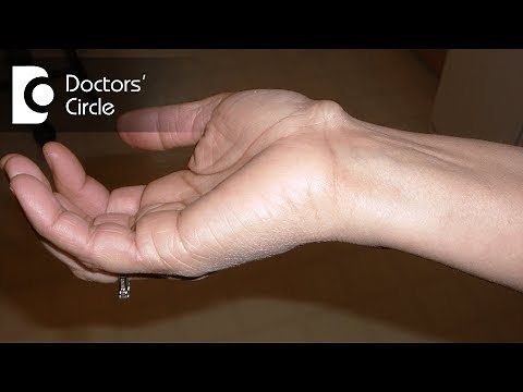 Causes and management of fluid filled cyst on wrist - Dr. Mohan M R