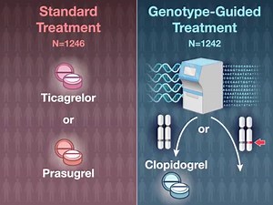 14K views · 456 reactions | In patients with STEMI undergoing PCI,...