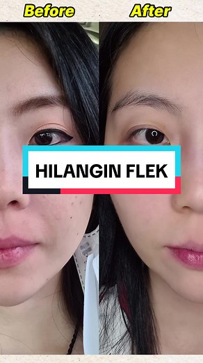 Rahasia Flek Hitam & Kerutan Part 1: Perjuangan Ratu Jessie Korea!