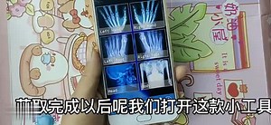 教你用手机开启“扫描仪”功能，手上的骨骼都能看的一清二楚