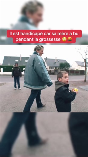Wilfried est handicapé parce que sa mère a bu pendant la grossesse #reportage #hopital #realcreator