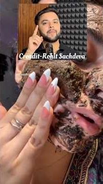 🔥 Rohit Sachdeva Inspired Roasted Turmeric Remedies for Glass Skin, Dark Circles & Glow