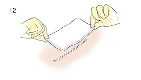 Step-by-Step: Changing a Surgical Incision Dressing