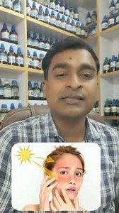 Sun ALLERGY SUN BURN SUN TAN &ITS HOMOEOPATHIC MEDICINE