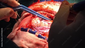 neurosurgeon perform craniotomy for patient