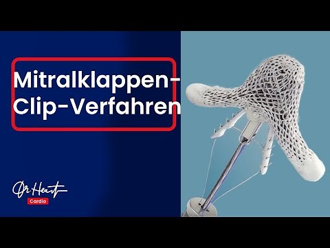 Repairing a heart valve without surgery! The MitraClip procedure | Dr. Heart